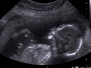 baby-profile-for-blog